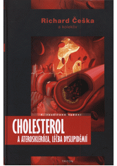 Cholesterol a ateroskleróza, léčba dyslipidémií